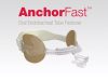 AnchorFast Oral Endotracheal Tube Fastener