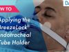 Dale BreezeLock® Endotracheal Tube Holder – How to Apply