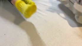 Ankle Contracture Splint Guide to Application and Wear