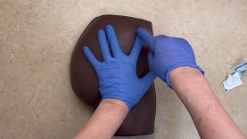 IM Injection Ventrogluteal Site