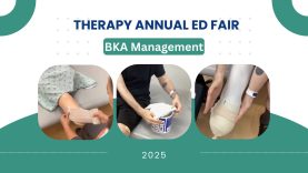 Residual Limb Management for BKA