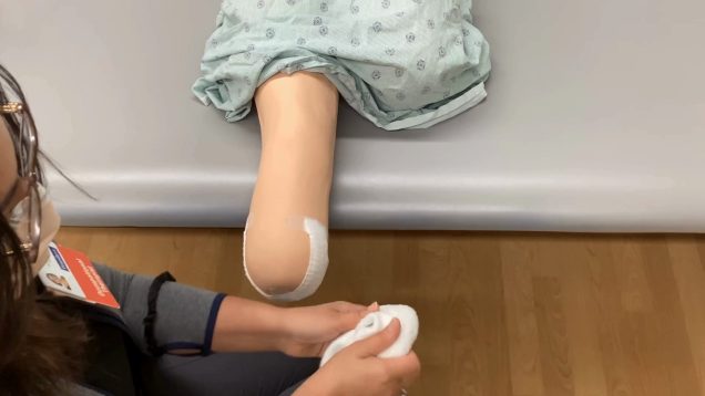 Residual Limb Management for BKA