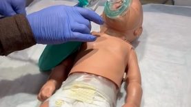 How to administer blow-by oxygen