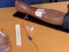 Therapeutic Phlebotomy Procedure